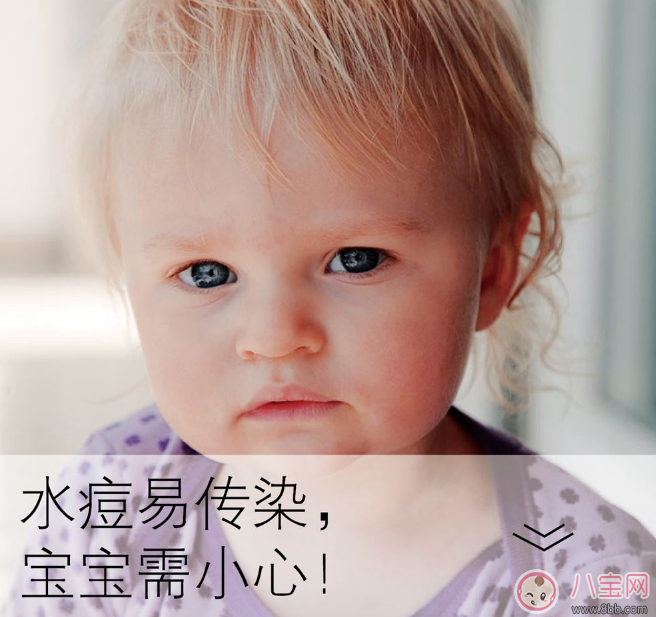 孩子長水痘這些東西千萬遠離 孩子水痘好得快方法 孩子長水痘這些東西千萬遠離 孩子水痘好得快方法