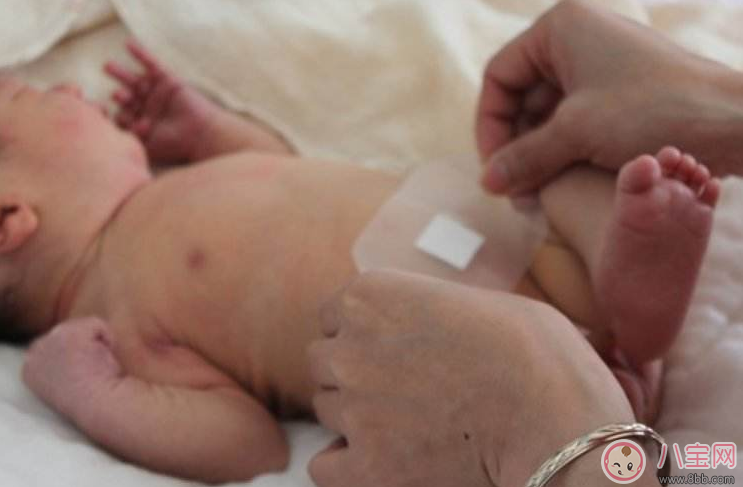 看到孩子肚臍這四種情況要當心 最好早點及時就醫(yī) 看到孩子肚臍這四種情況要當心 最好早點及時就醫(yī)