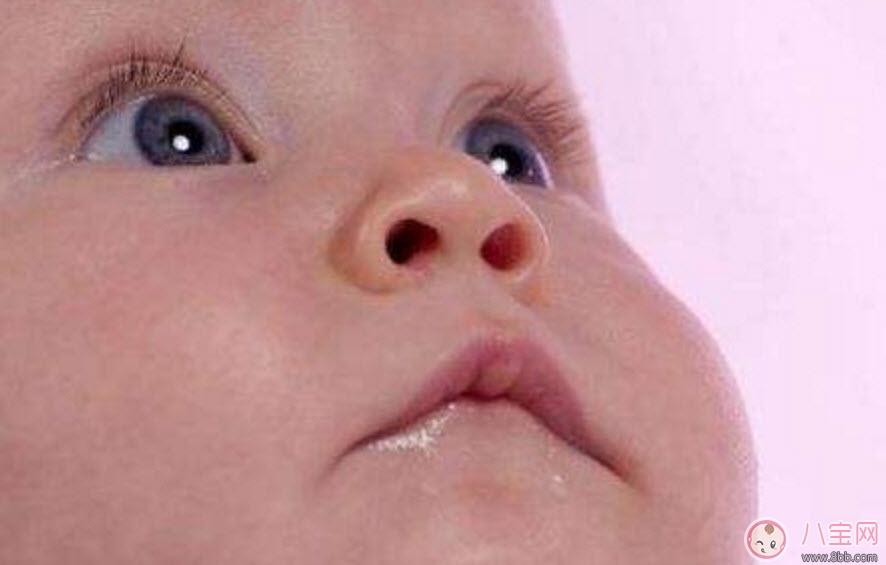 寶寶斜視手術(shù)風(fēng)險(xiǎn)大嗎 寶寶斜視一定要做手術(shù)嗎 寶寶斜視手術(shù)風(fēng)險(xiǎn)大嗎 寶寶斜視一定要做手術(shù)嗎