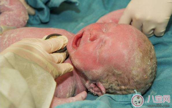 剛出生的寶寶不能洗澡 孩子出生多久可以洗