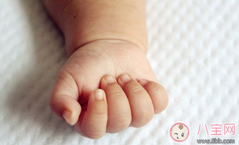 孩子手上長(zhǎng)倒刺 寶媽?xiě)?yīng)該這么做 孩子手上長(zhǎng)倒刺 寶媽?xiě)?yīng)該這么做