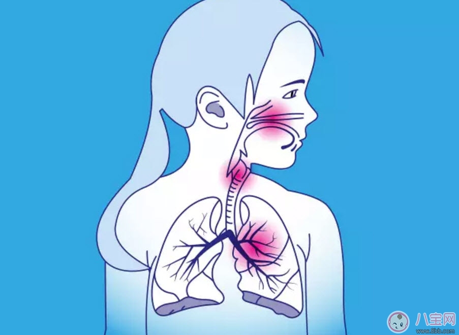 寶寶肺炎反反復復怎么辦 寶寶得了肺炎怎么治療 寶寶肺炎反反復復怎么辦 寶寶得了肺炎怎么治療