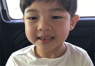 孩子換牙牙不掉 孩子雙排牙要不要拔