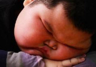 小孩肥胖的危害有哪些 2017兒童肥胖問(wèn)題大全