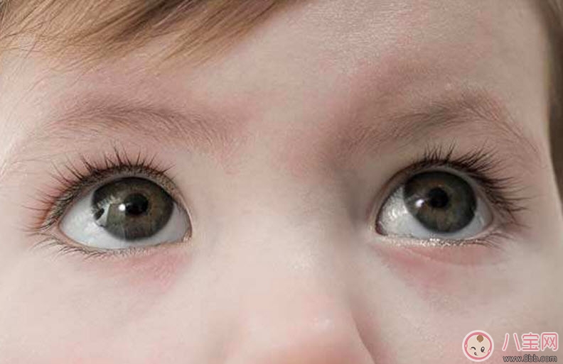 哪些情況要給寶寶用眼藥水 寶寶眼藥水怎么滴