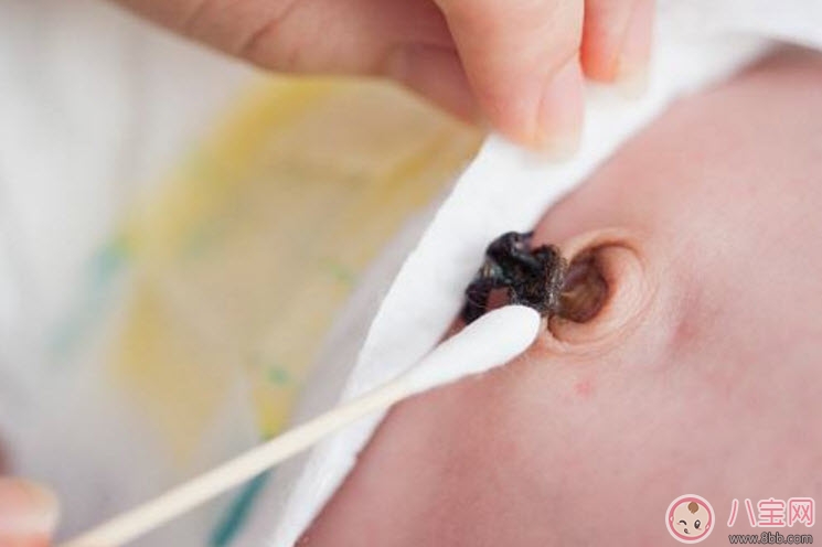 新生兒臍帶消毒用什么 臍帶消毒用碘伏好還是酒精(肚臍消毒圖解)