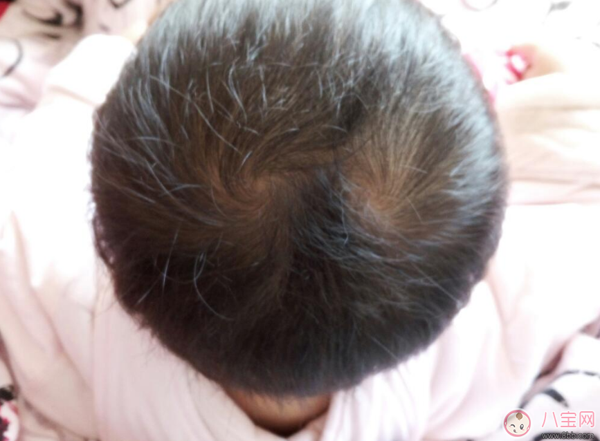 孩子頭上的旋有什么含義 幾個旋比較聰明 孩子頭上的旋有什么含義 幾個旋比較聰明