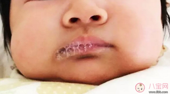 寶寶吐泡泡就是肺炎嗎 寶寶吐泡泡是怎么回事