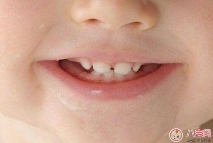 寶寶長牙順序 寶寶長牙特征(寶寶長牙癥狀) 寶寶長牙順序 寶寶長牙特征(寶寶長牙癥狀)