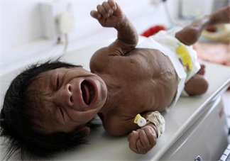 孩子這種情況居然是營(yíng)養(yǎng)不良的暗示 快給孩子調(diào)整過來