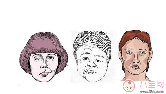 兒童吹空調(diào)竟然導致面癱 如何正確吹空調(diào) 兒童吹空調(diào)竟然導致面癱 如何正確吹空調(diào)