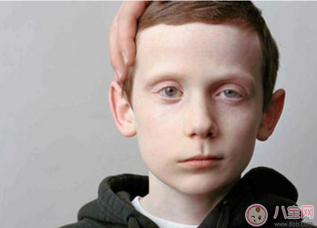 兒童吹空調(diào)竟然導致面癱 如何正確吹空調(diào) 兒童吹空調(diào)竟然導致面癱 如何正確吹空調(diào)