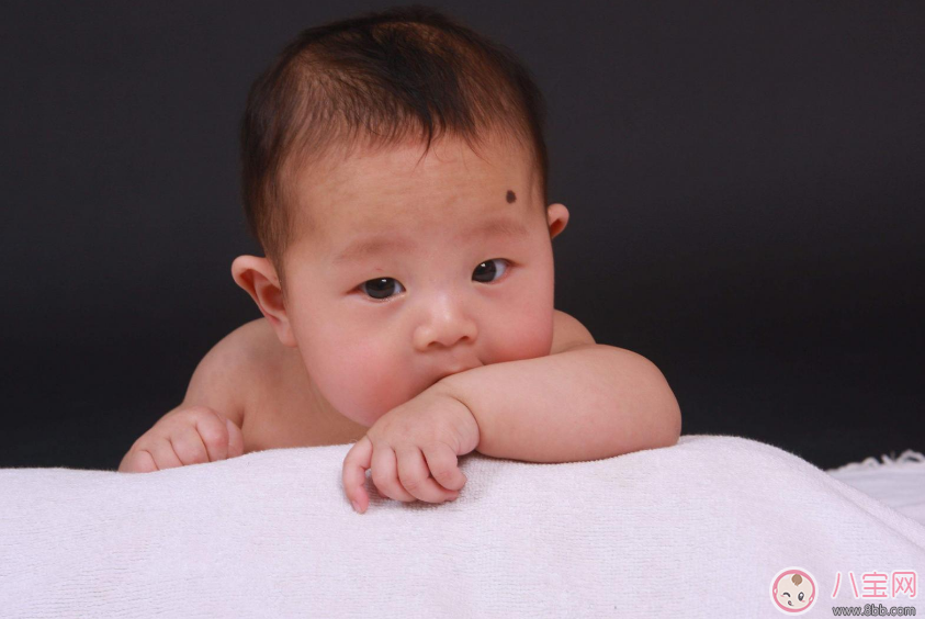 寶寶胎記會自己掉嗎 寶寶胎記去除方法