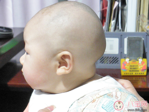 寶寶頭型塑造方法 2017寶寶頭型塑造注意事項 寶寶頭型塑造方法 2017寶寶頭型塑造注意事項