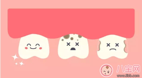 董潔兒子頂頂四顆蛀牙 寶寶更易患蛀牙問題 董潔兒子頂頂四顆蛀牙 寶寶更易患蛀牙問題