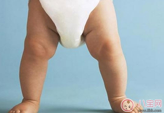怎樣讓寶寶有大長(zhǎng)腿 寶寶腿型注意事項(xiàng)