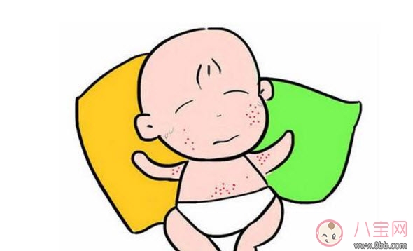 2017夏天孩子長痱子有什么偏方 去治痱子偏方有哪些 2017夏天孩子長痱子有什么偏方 去治痱子偏方有哪些