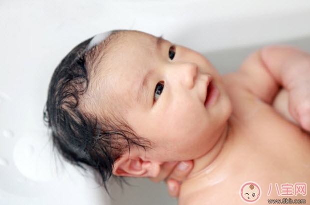 頭垢對(duì)寶寶的影響 頭垢怎么去除有哪些注意事項(xiàng) 頭垢對(duì)寶寶的影響 頭垢怎么去除有哪些注意事項(xiàng)