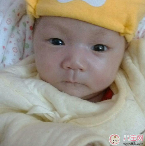 寶寶眼睛有好多眼屎需要馬上就醫(yī) 寶寶哪些情況千萬不能耽擱 寶寶眼睛有好多眼屎需要馬上就醫(yī) 寶寶哪些情況千萬不能耽擱