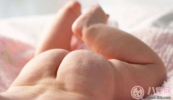 嬰兒長(zhǎng)尿布疹怎么辦 尿布疹是怎么引起的 嬰兒長(zhǎng)尿布疹怎么辦 尿布疹是怎么引起的