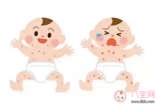 寶寶長(zhǎng)痱子怎么辦 給寶寶去痱子的方法有哪些 寶寶長(zhǎng)痱子怎么辦 給寶寶去痱子的方法有哪些