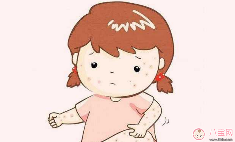 寶寶長(zhǎng)痱子怎么辦 給寶寶去痱子的方法有哪些 寶寶長(zhǎng)痱子怎么辦 給寶寶去痱子的方法有哪些