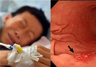 英國(guó)5歲癌癥寶寶去世 小孩癌癥的早期信號(hào)有哪些