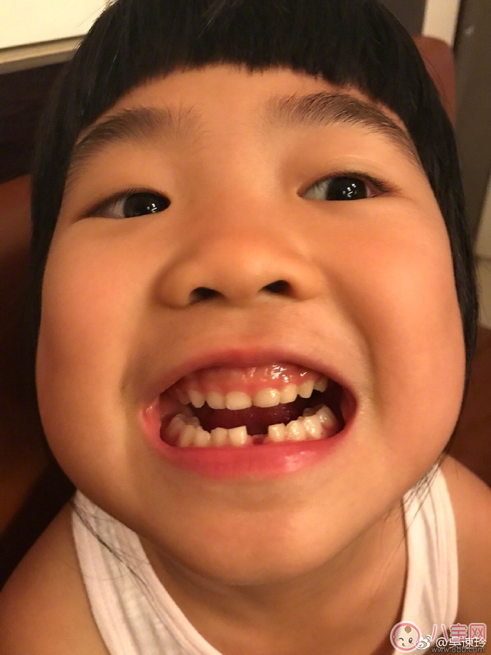 姐姐grace掉牙表情古怪 孩子什么時候掉牙最好
