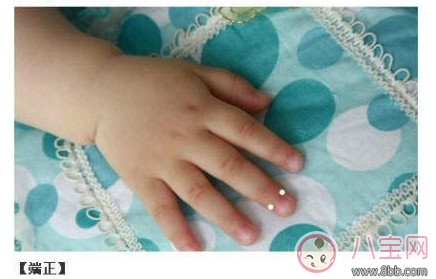 寶寶推拿大全 嬰幼兒常見病的最強克星 寶寶推拿大全 嬰幼兒常見病的最強克星