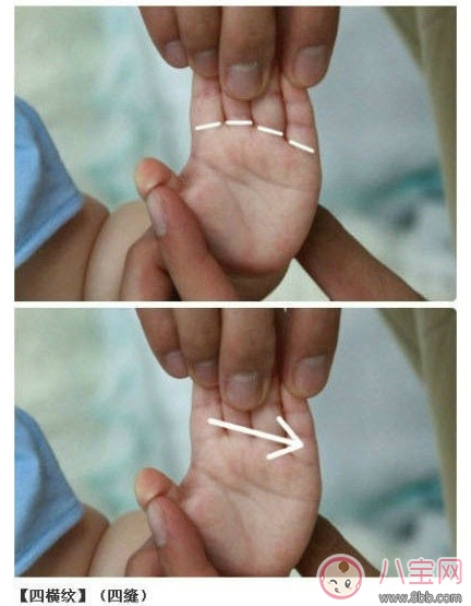 寶寶推拿大全 嬰幼兒常見病的最強克星 寶寶推拿大全 嬰幼兒常見病的最強克星