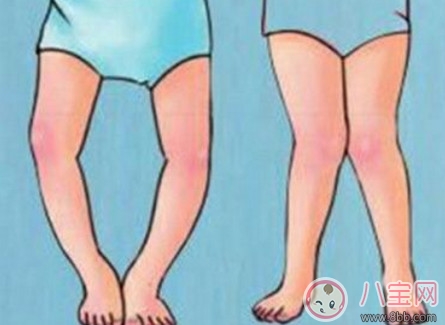 嬰兒扶站 寶寶過早被扶站的弊端(平衡感 O形腿 不愛爬)