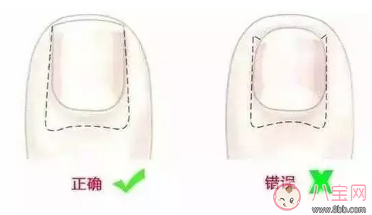 寶寶指甲太長抓人怎么辦 正確給寶寶剪指甲方法 寶寶指甲太長抓人怎么辦 正確給寶寶剪指甲方法