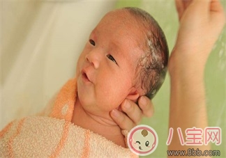 寶寶乳痂多怎么辦    怎么清洗乳痂
