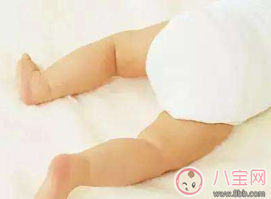 寶寶腿太彎怎么辦 怎么讓寶寶有一雙筆直的腿 寶寶腿太彎怎么辦 怎么讓寶寶有一雙筆直的腿