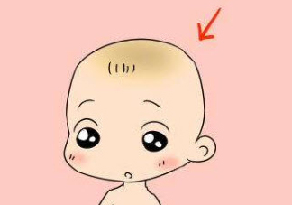 舅舅屎是什么 寶寶頭上的舅舅屎怎么去除[!--empirenews.page--]舅舅屎是什么?