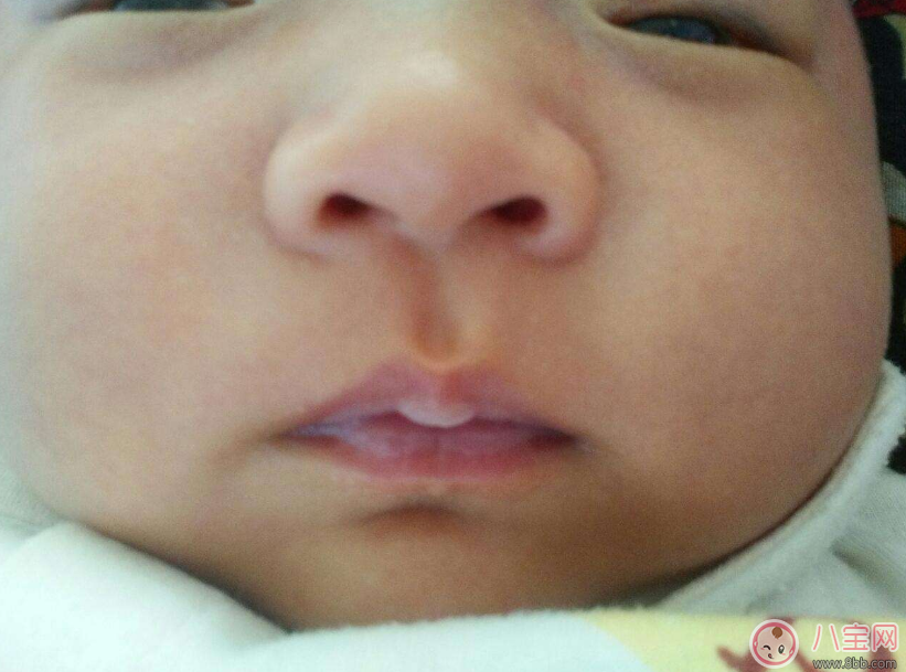 孩子脾虛的癥狀是什么 哪些情況是孩子脾虛了 孩子脾虛的癥狀是什么 哪些情況是孩子脾虛了