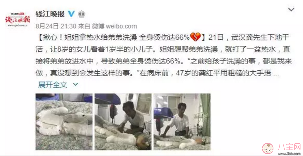 父母讓8歲姐給1歲弟洗澡 “洗”成一場大禍 父母讓8歲姐給1歲弟洗澡 “洗”成一場大禍