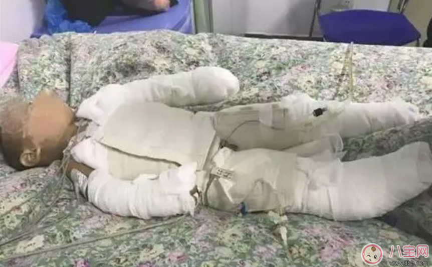 父母讓8歲姐給1歲弟洗澡 “洗”成一場大禍 父母讓8歲姐給1歲弟洗澡 “洗”成一場大禍