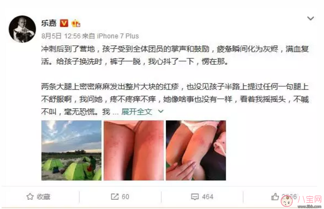 樂(lè)嘉帶4歲女兒穿越沙漠徒步76公里 女兒腿上發(fā)滿(mǎn)皰疹