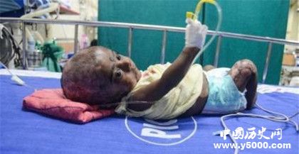 人體自燃是什么現(xiàn)象 人體自燃案列介紹 人體自燃是什么現(xiàn)象 人體自燃案列介紹