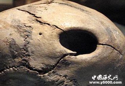 古代人有開顱手術(shù)嗎 古代人治療腦科疾病的方法 古代人有開顱手術(shù)嗎 古代人治療腦科疾病的方法