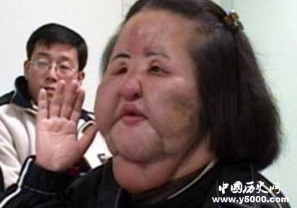 韓國風扇女去世韓國風扇女簡歷風扇女為什么會癡迷整容 韓國風扇女去世韓國風扇女簡歷風扇女為什么會癡迷整容