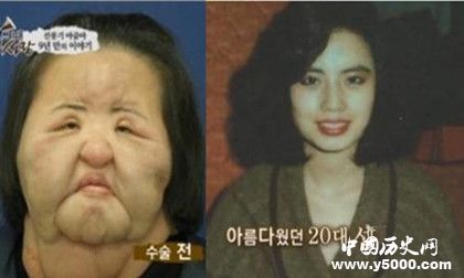 韓國風扇女去世韓國風扇女簡歷風扇女為什么會癡迷整容