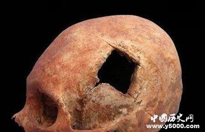 古代人有開顱手術(shù)嗎 古代人治療腦科疾病的方法 古代人有開顱手術(shù)嗎 古代人治療腦科疾病的方法