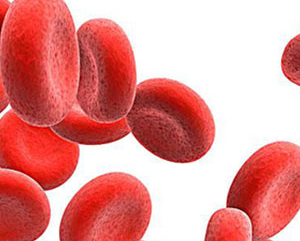 貧血的癥狀大起底 這些預(yù)防貧血的知識你都知道嗎