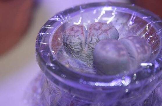 生石花怎么水培，教你四個基本步驟快速水培生根