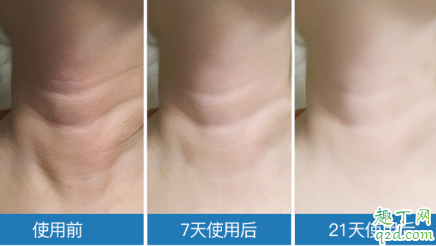 米加頸霜有沒有效果 米加頸霜使用評測6