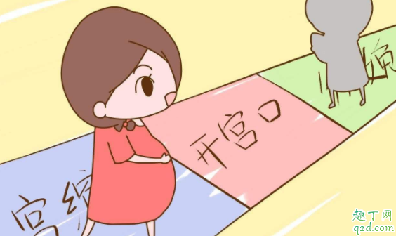 快速開宮口吃什么 有沒有促進宮口開得快的方法1