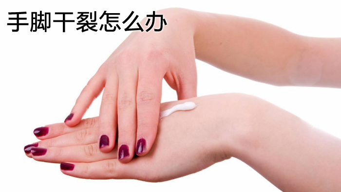 手腳干裂怎么辦