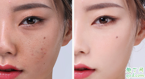 素萃黑醋面膜好用嗎 素萃黑醋面膜使用測評2